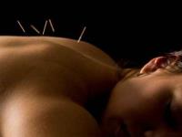 Acupuncture Training Courses Toronto image 2